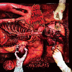 LP / 200 Stab Wounds / Manual Manic Procedures / Coloured / Vinyl