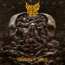 LP / Defeated Sanity / Chronicles Of Lunacy / Vinyl