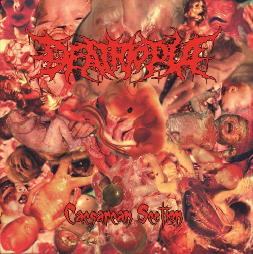 LP / Deathtopia / Caesarean Section / Vinyl
