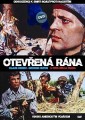 DVDFILM / Otev�en� r�na
