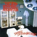 CDDead Infection / Surgical Disembowelment