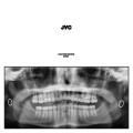 2LPVan Cleaf Jack / Jvc / Vinyl / 2LP