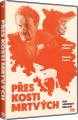 DVDFILM / Pes kosti mrtvch